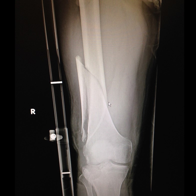 EMS World Special Supplement Combating the Hidden Dangers of Shock in